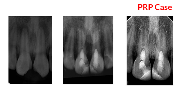 Dental Treatment