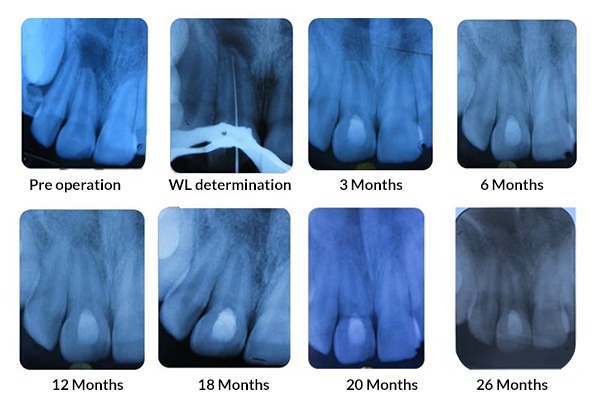 Dental Treatment