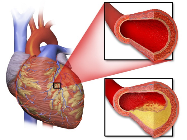 Senior Interventional Cardiologist in Fortis Hospital Kolkata