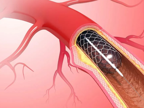 Senior Interventional Cardiologist in Fortis Hospital Kolkata