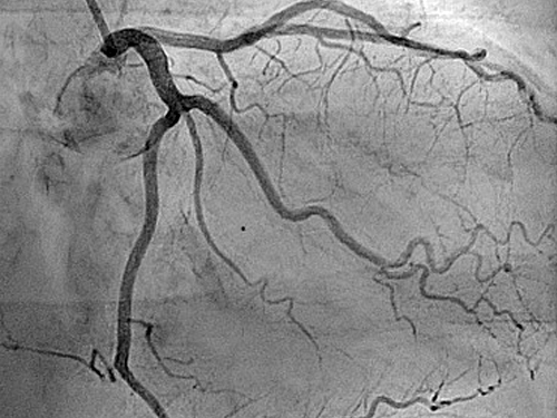 Best Cardiologist in EM Bypass Kolkata