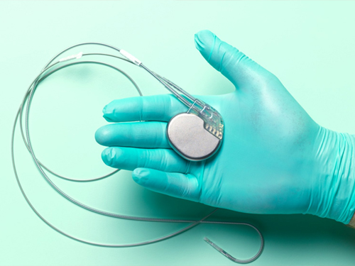 Pacemaker Implantation in Kolkata