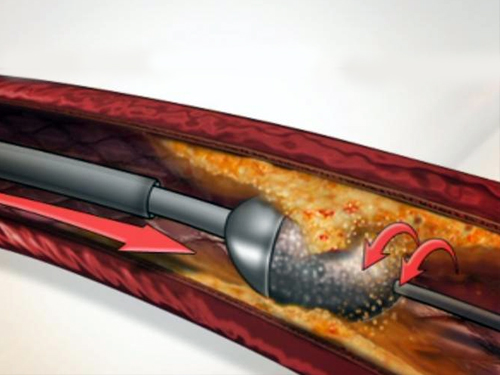 Senior Interventional Cardiologist in Kasba Kolkata